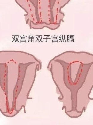 在福州做试管婴儿选择哪家医院比较好？