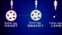 详细了解青岛试管婴儿流程，建议收藏